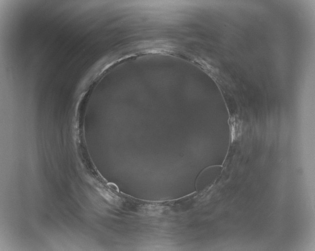 X0000068810339200605081125