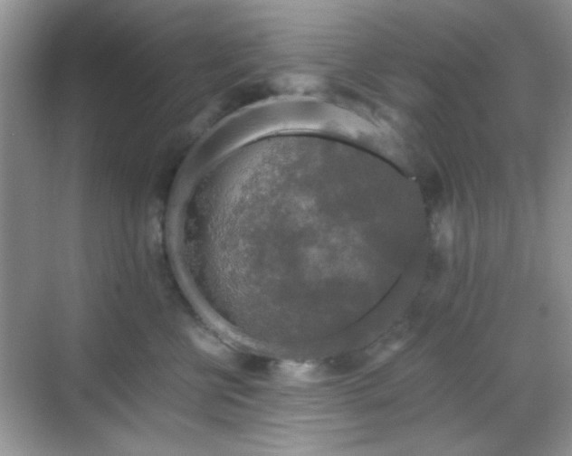 X0000068810570200605081122