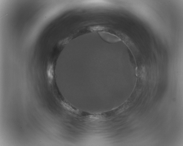 X0000068810763200605081119