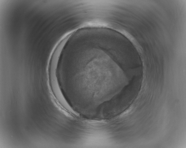 X0000068810864200605081118