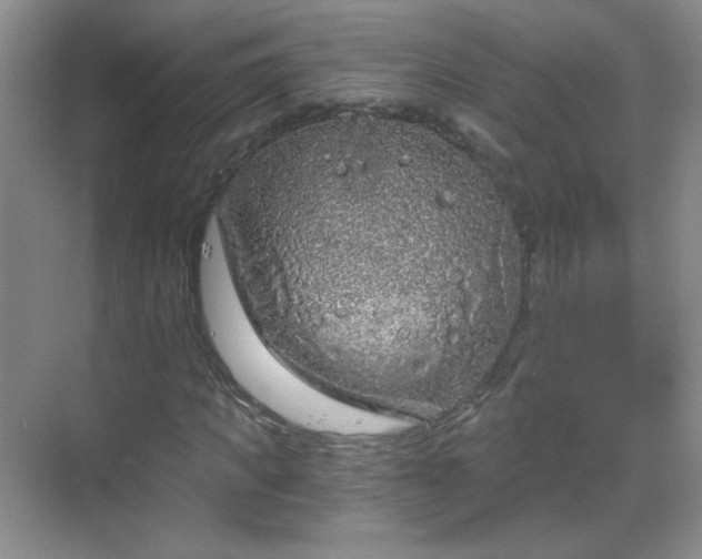 X0000068810917200605081115