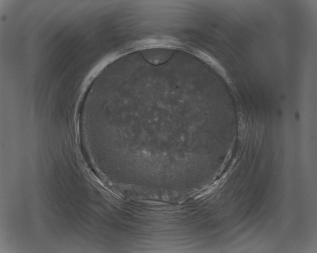 X0000068811419200605121239