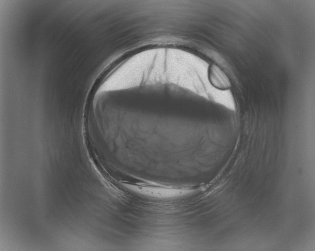 X0000068811229200606021542