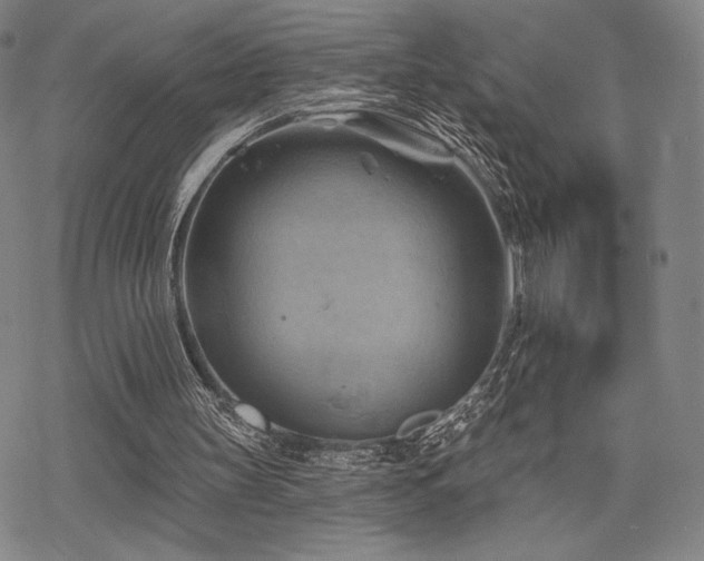 X0000068820147200605051219