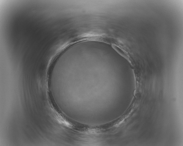 X0000068820149200605081154