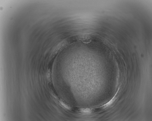 X0000068820144200605121325