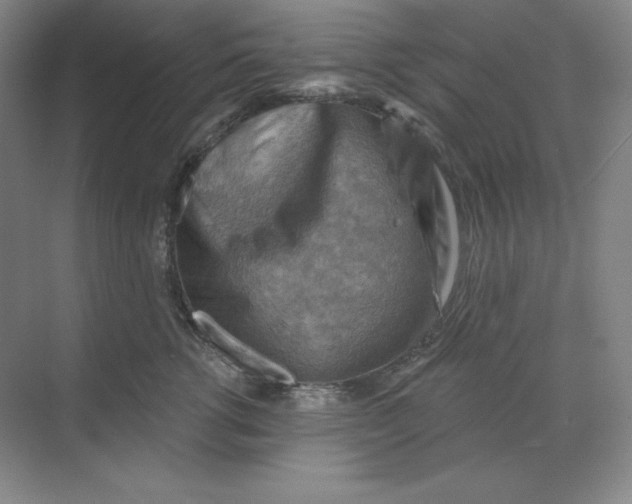 X0000068820762200605191833