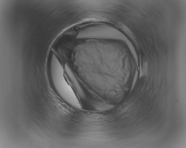 X0000068820387200606021622