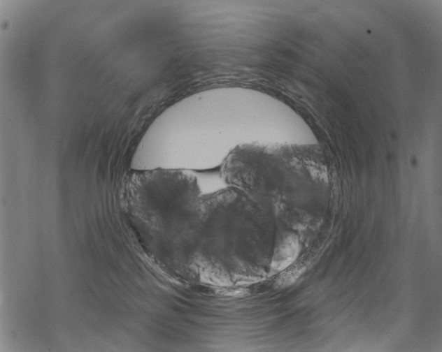 X0000068840185200605050953