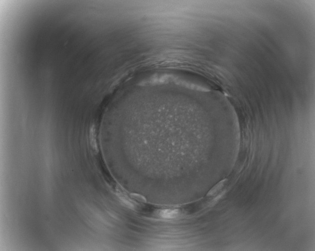 X0000068840575200605081242