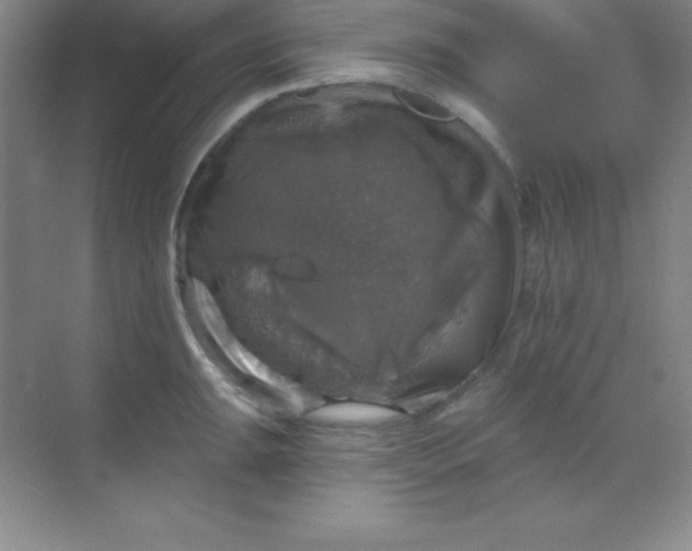 X0000068841047200605191920