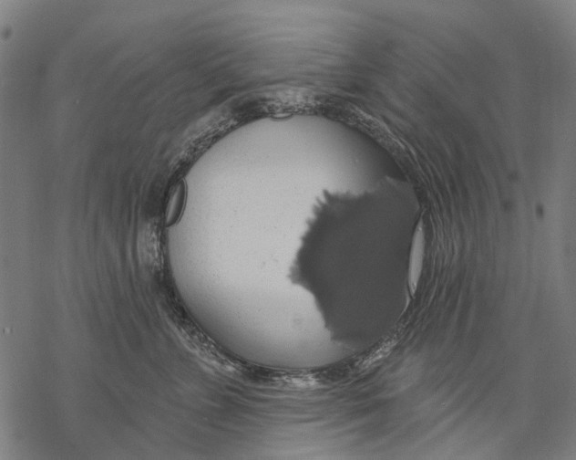 X0000068840715200605261640