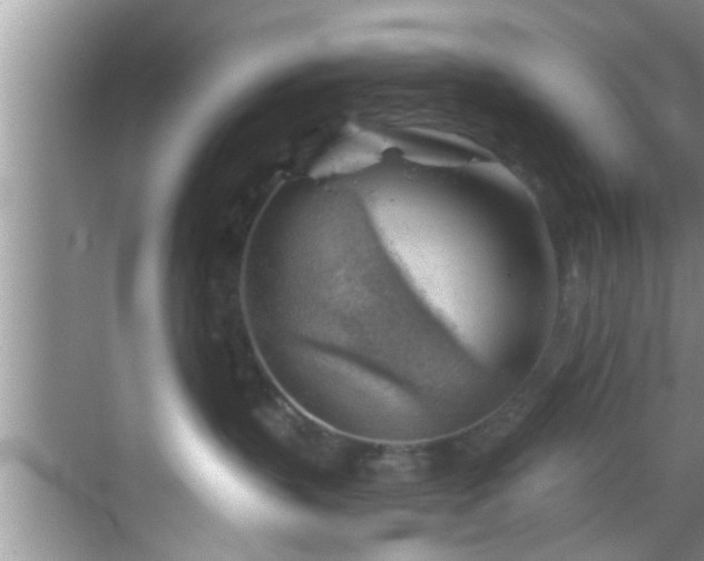 X0000068850383200605121415