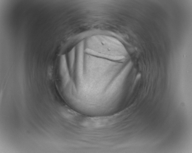 X0000068850033200605192003