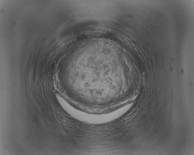 X0000068851059200605261700