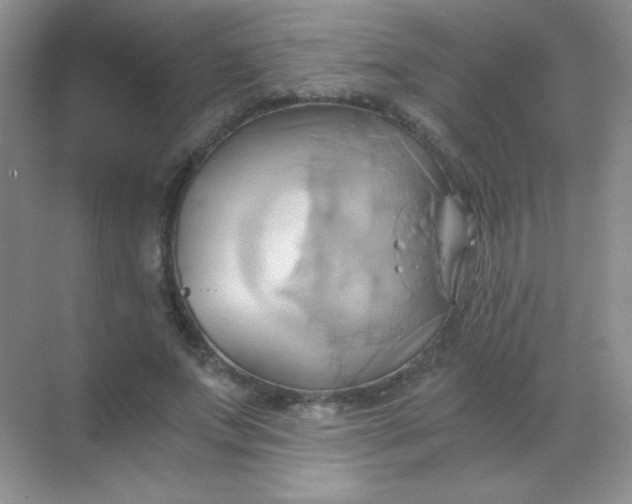 X0000068860687200605192018