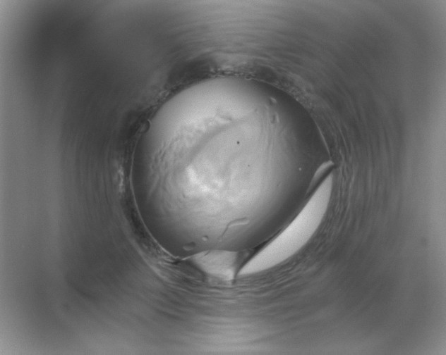 X0000068860703200605192017