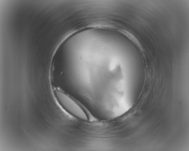 X0000068860855200605192015