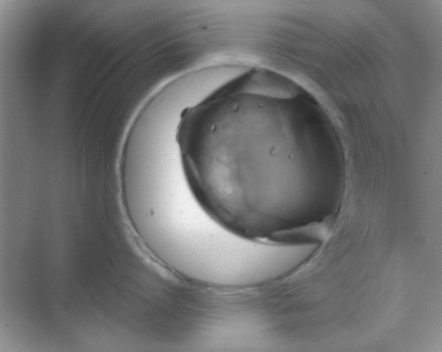 X0000068860864200605192015