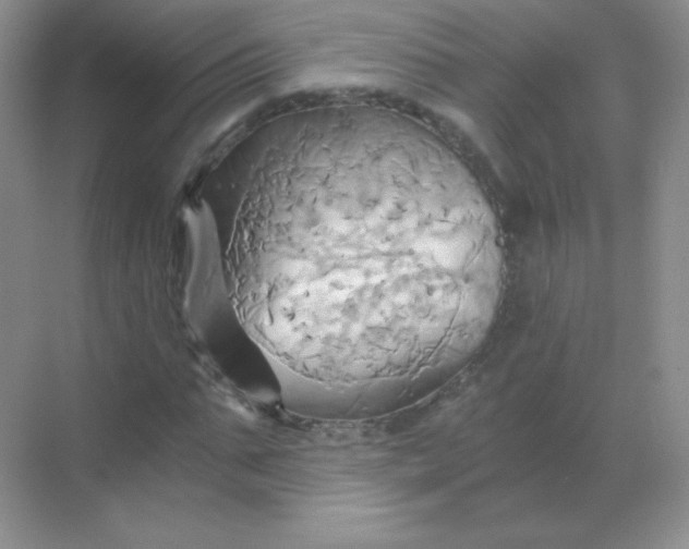 X0000068860871200605192014