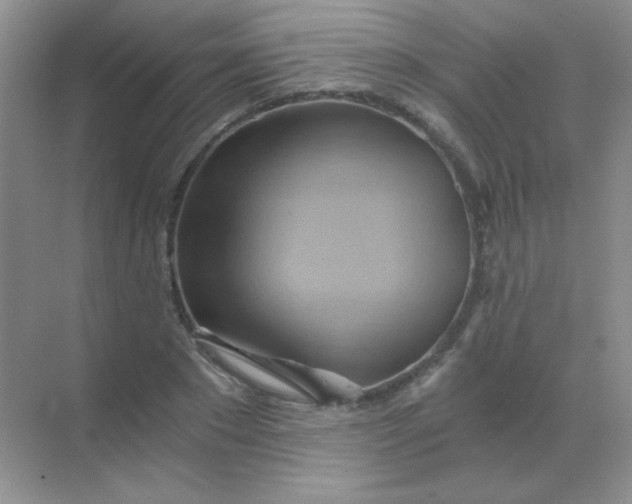 X0000068860881200605192014