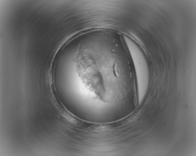 X0000068860891200605192014