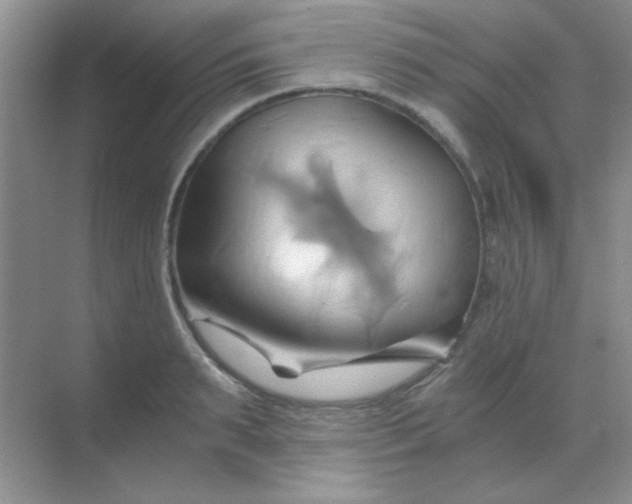 X0000068860895200605192014