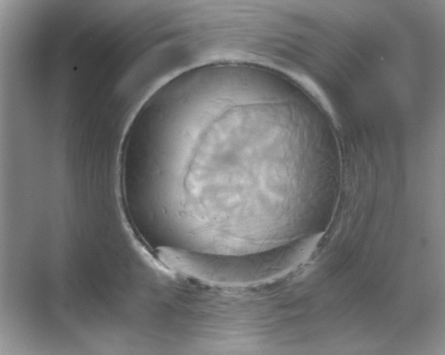 X0000068860903200605192014