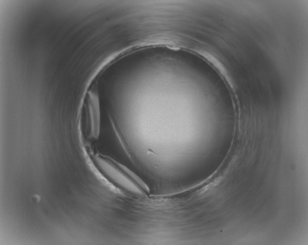 X0000068860949200605192014