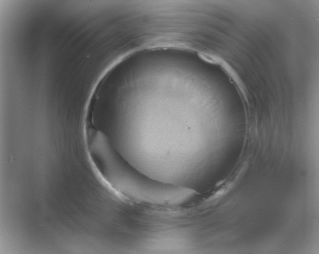 X0000068860957200605192014