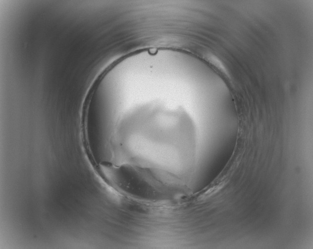 X0000068861087200605192011