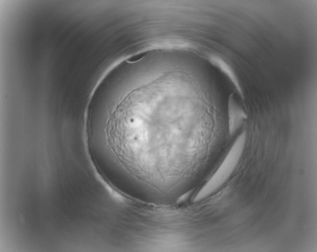 X0000068861103200605192011