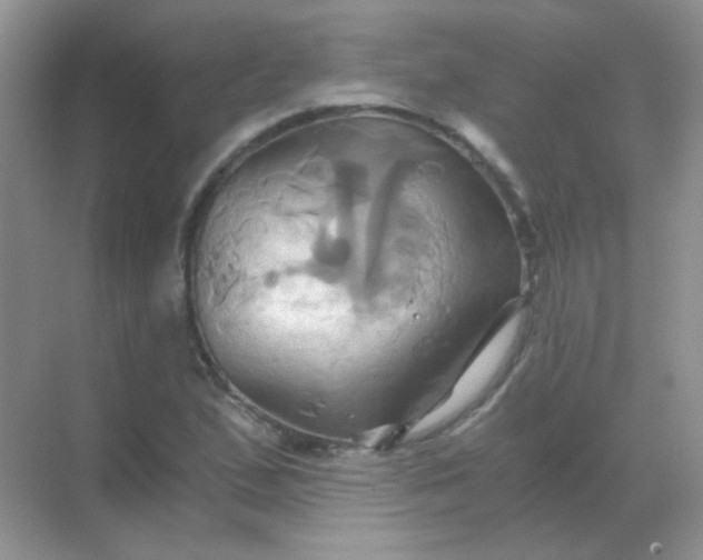 X0000068861167200605192009