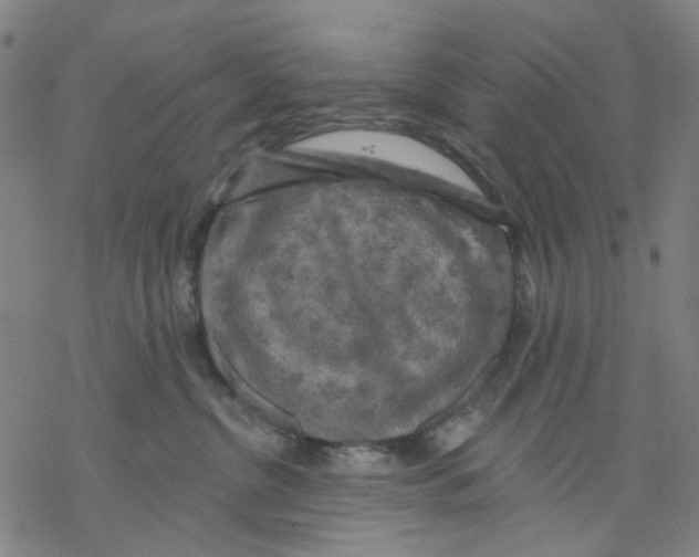 X0000068890380200605261852