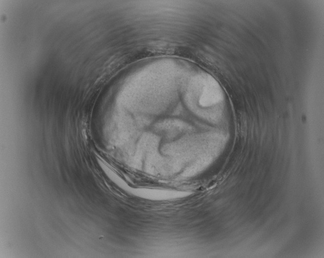 X0000068901154200605261904