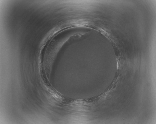 X0000069360339200605121122