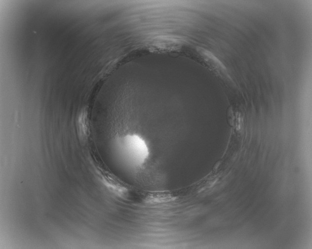 X0000069360915200605121112