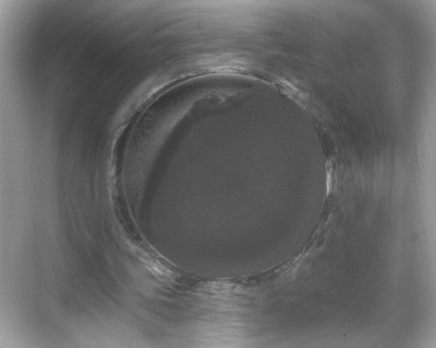 X0000069360339200605150922