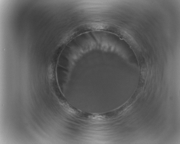 X0000069360359200605150922