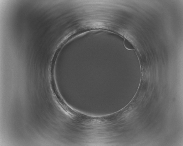 X0000069360390200605150922