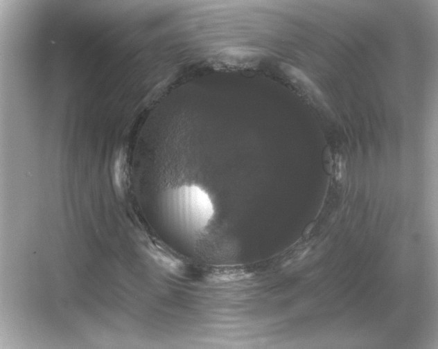 X0000069360915200605150912