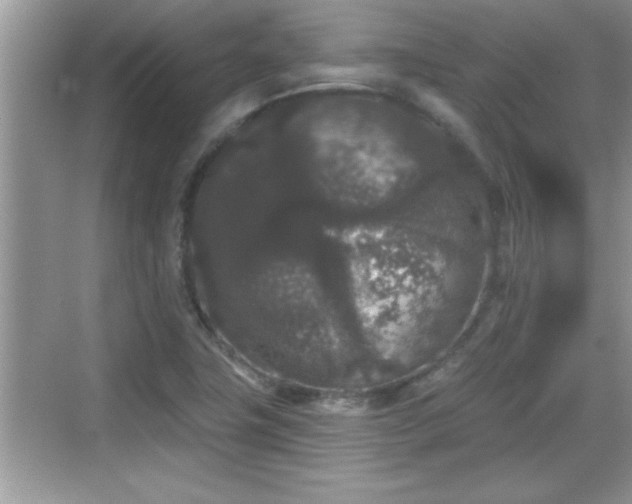 X0000069361411200605150904