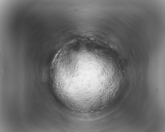 X0000069360030200605262010