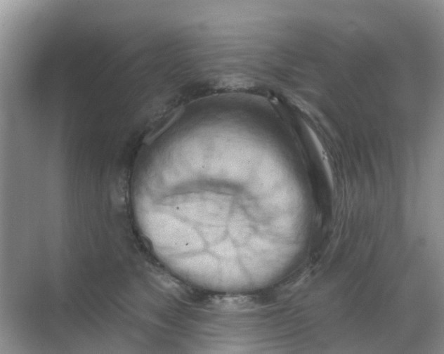 X0000069360517200605262002