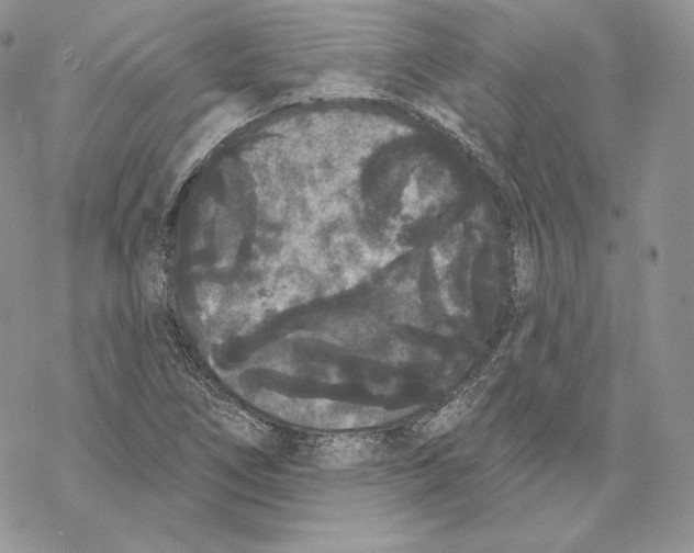 X0000069361266200606091552