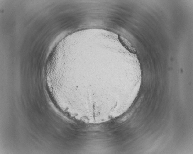 X0000069361382200606091550