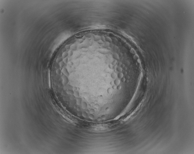 X0000069381171200605121138