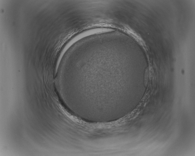 X0000069380009200605150929