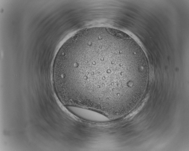 X0000069380957200605150914