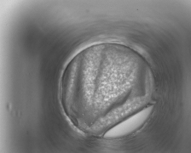 X0000069381520200605262037